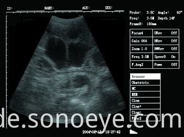 v5 pet ultrasound